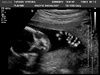 Bean at 20 weeks! Everything looks to be as it should. Two legs, two hands, big brain, a nose!