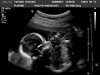 Bean at 20 weeks! Everything looks to be as it should. Two legs, two hands, big brain, a nose!