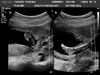 Bean at 20 weeks! Everything looks to be as it should. Two legs, two hands, big brain, a nose!
