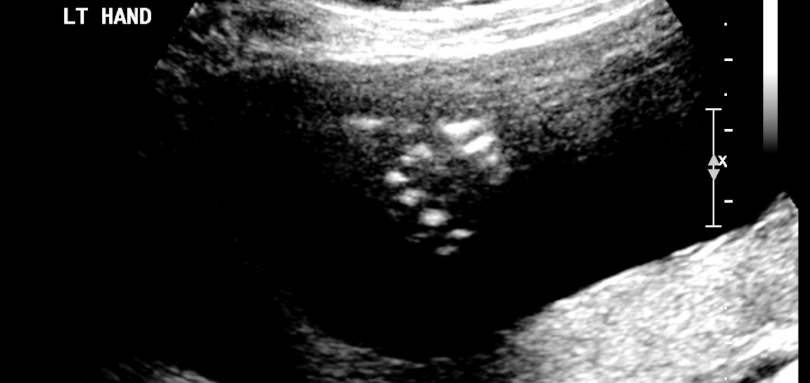 The thumbs up from Pixel saying everything is A-O-K at the 20 week scan. Hard to believe we are halfway there already!